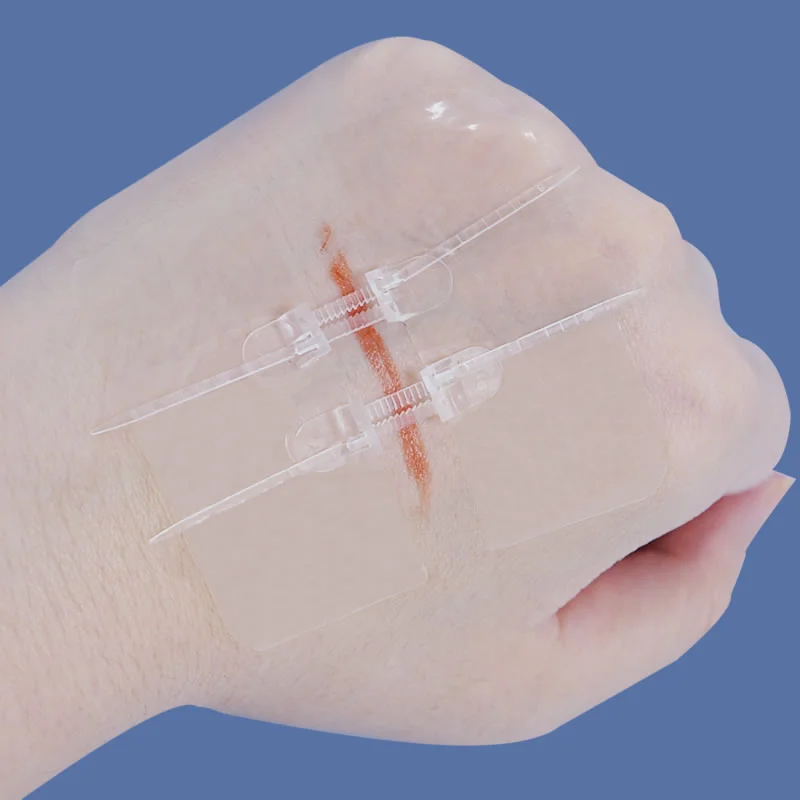 Refill Kits